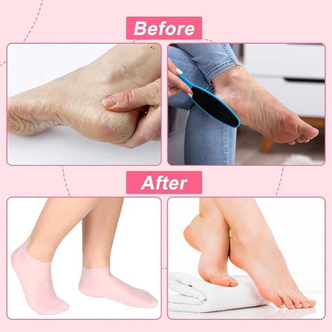 Silicone Gel Moisturizing Spa Socks – Exfoliating, Anti-Slip, Heel & Foot Care for Dry, Cracked Skin (Unisex)